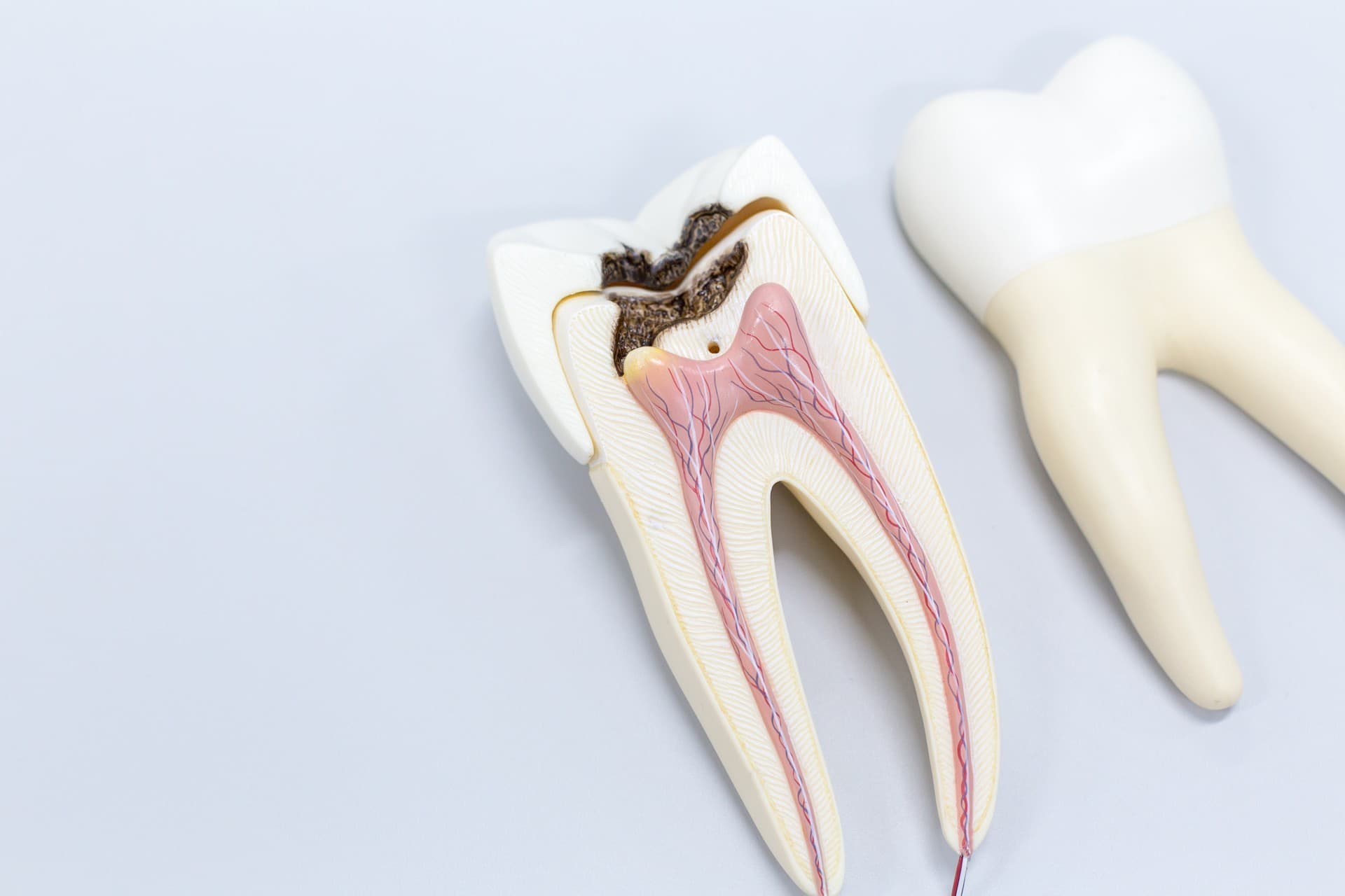 Endodoncia precio en Ferrol