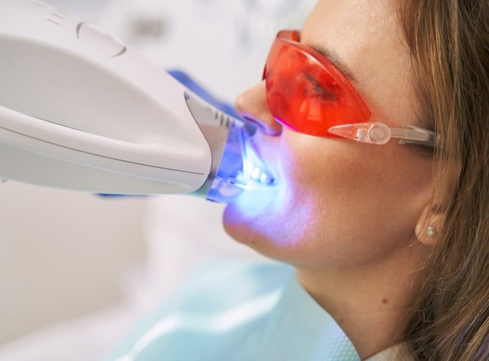 Blanqueamiento dental