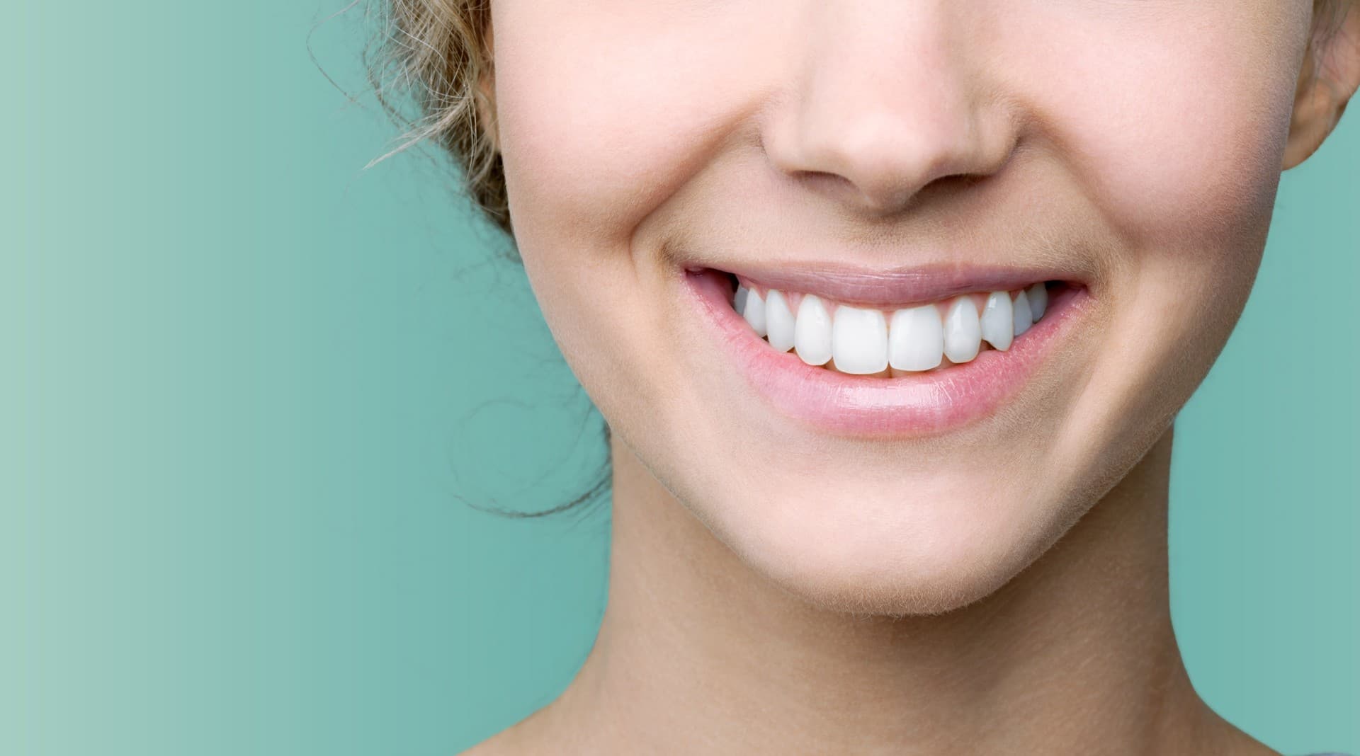 ¿A qué esperas para mejorar tu sonrisa?