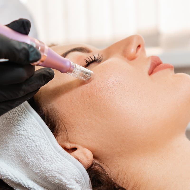 Piel renovada con mesoterapia facial en Ferrol