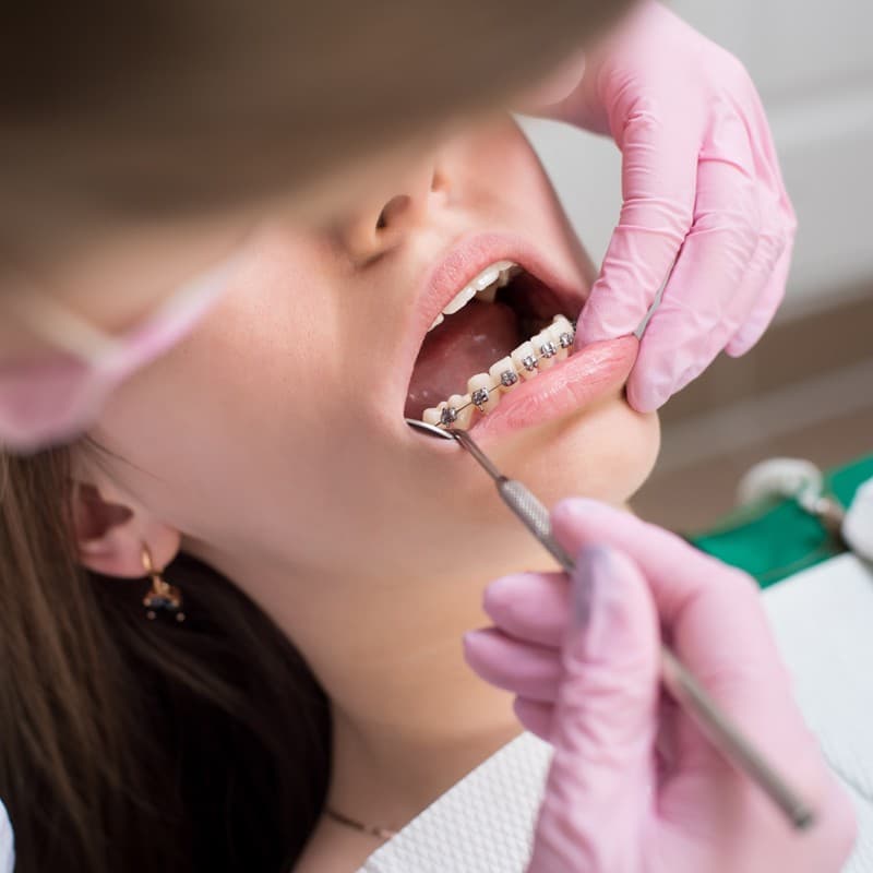 Transforma tu sonrisa con ortodoncia