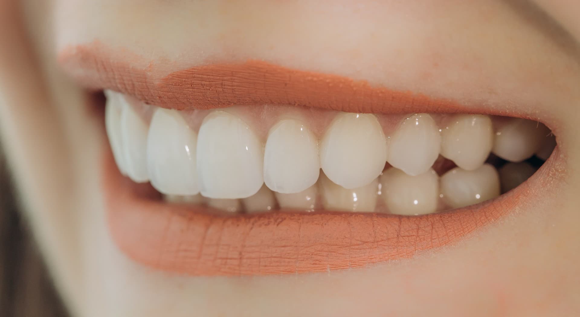 ¿A qué esperas para mejorar tu sonrisa?