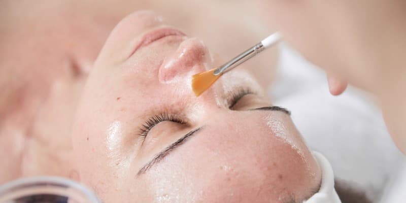Peeling medio