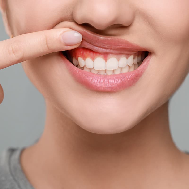Tratamientos periodontales en Ferrol