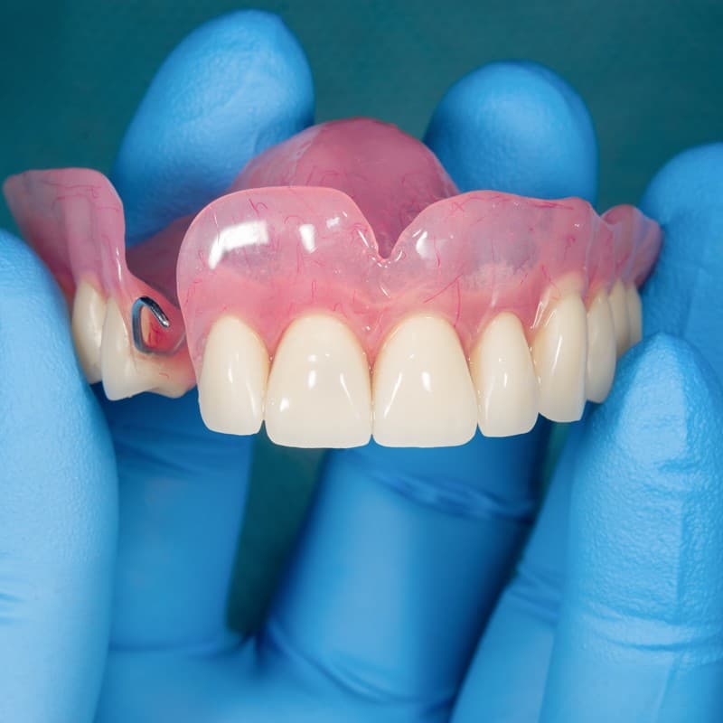 Recupera la funcionalidad de tu boca con prótesis dentales